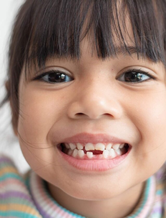 Shed Teeth Image Shed Teeth Image